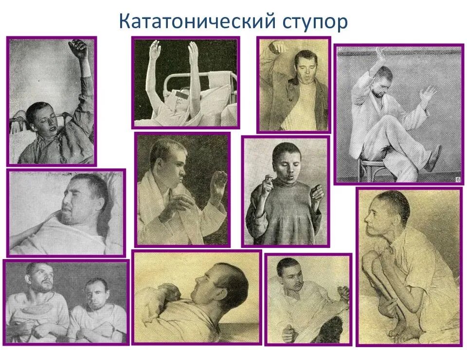 Симптом павлова. Кататонический синдром психиатрия. Ступор болезнь кататонический. Кататоническая форма шизофрении симптомы. Кататонический ступор шизофрения.