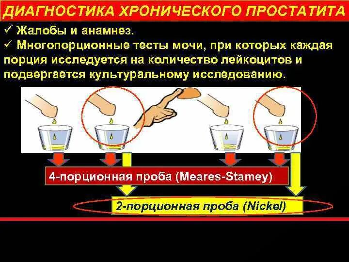 Можно вылечить хронический простатита навсегда. Диагностика простатита. самодиагностика простаты. хронический простатит диагностика. основной метод диагностики хронического простатита.