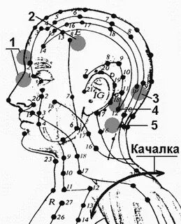 Правка черепа