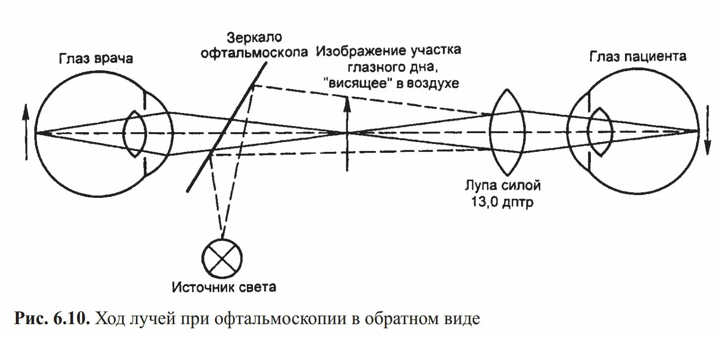 Воздух через глаз. Схема непрямого офтальмоскопа. Схема лучей при обратной офтальмоскопии. Ход лучей при офтальмоскопии в обратном виде. Схема непрямой офтальмоскопии.