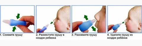 Сопли у детей как избавиться