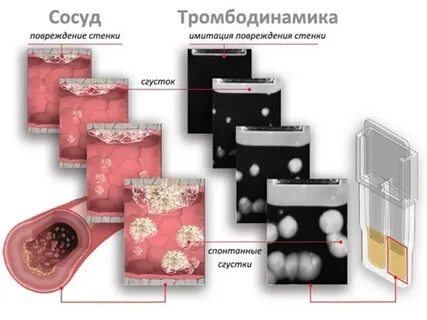 Тромбодинамика