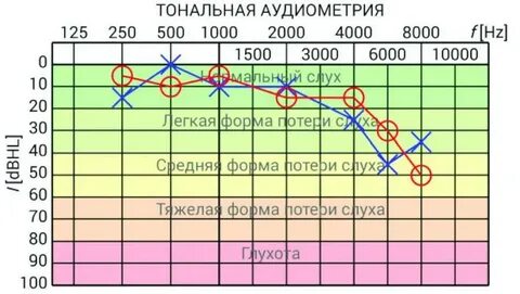 Аудиометрия где