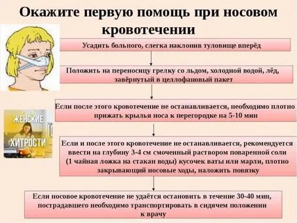 Техника остановки носового кровотечения
