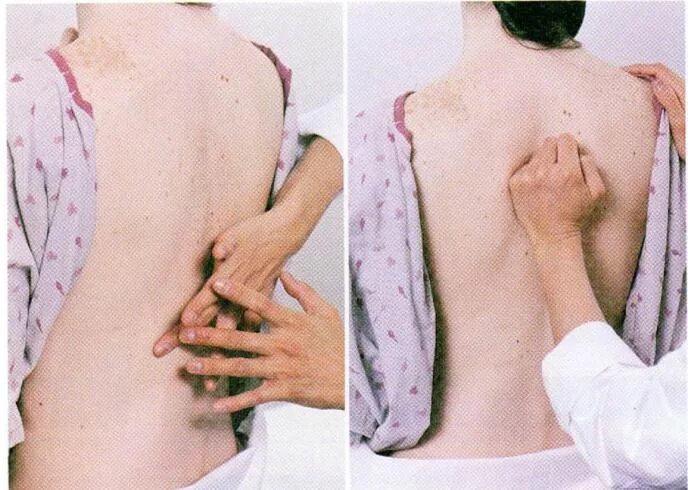 Метод перкуссии. Перкуссия тела. Перкуссия метод исследования. Клиническая топография грудной клетки пропедевтика. Сравнительная перкуссия легких в норме.