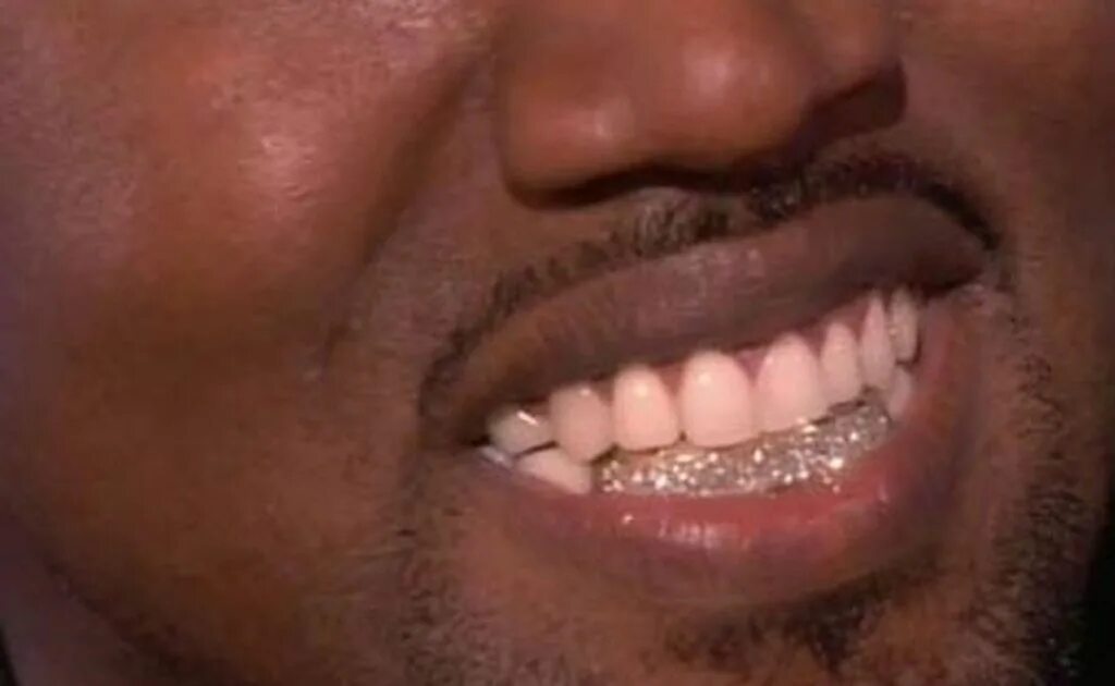 Канье титановые зубы. Грилзы lil wayne. Канье титановые зубы. Lil wayne grillz. Канье вест grillz.