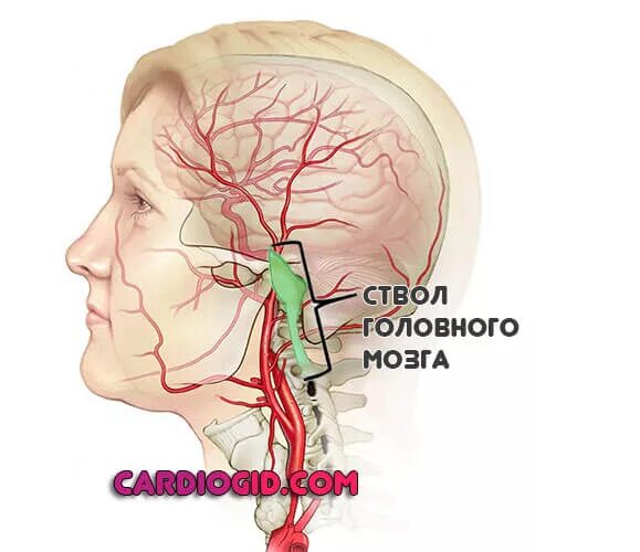 Поражение ствола головного. Клиника поражения ствола головного мозга. Инсульт ствола головного мозга. Инсульт в затылочной доле. Ишемический инсульт ствола мозга.