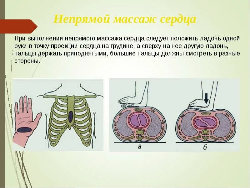 Последовательность первой помощи при остановке сердца. Оказание первой помощи при остановке сердца ОБЖ. Остановка сердца презентация. ПМП при внезапной остановке сердца. Алгоритмы помощи при остановке сердца