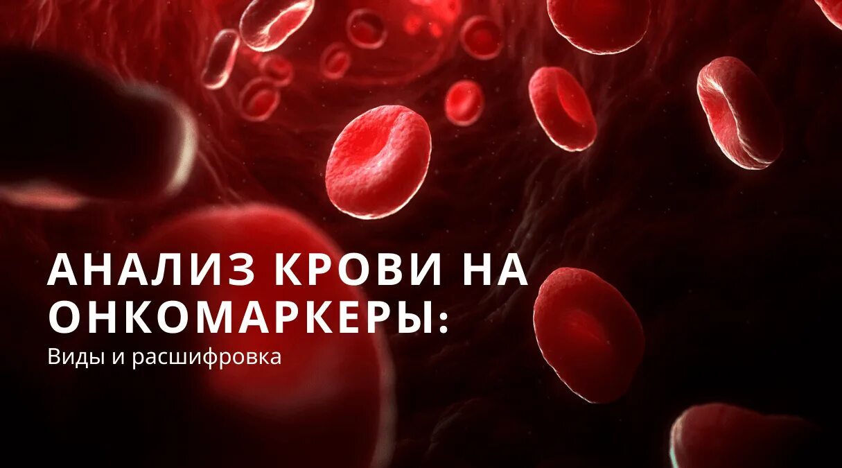 Опухолевые заболевания крови. Онкомаркеры. Исследование на онкомаркеры. Онкозаболевания крови