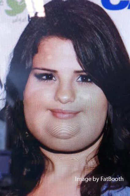 красная волчанка у селены гомес. красная волчанка у селены гомес. болезнь селены гомес.