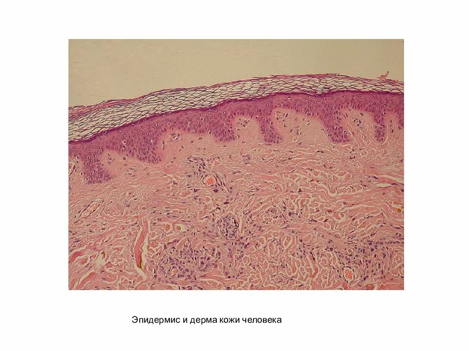 Эпидермис дерма гиподерма. Сосочковый слой кожи. Гиподерма кожи гистология. Эпидермис дерма гиподерма гистология.