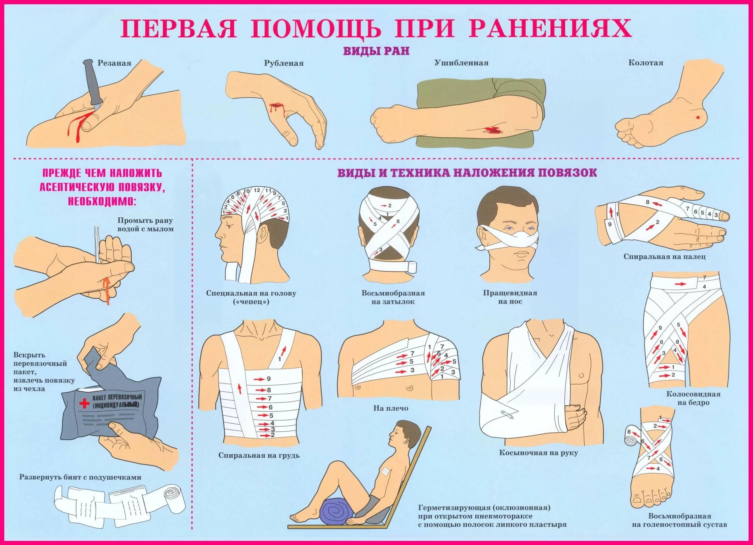 Способы наложения повязок при кровотечении. Оказание первой медицинской помощи при осколочных ранениях. Первый этап оказания первой помощи при ранениях. Принципы оказания медицинской помощи при ранениях. Оказание первой помощи при ранениях и кровотечениях.