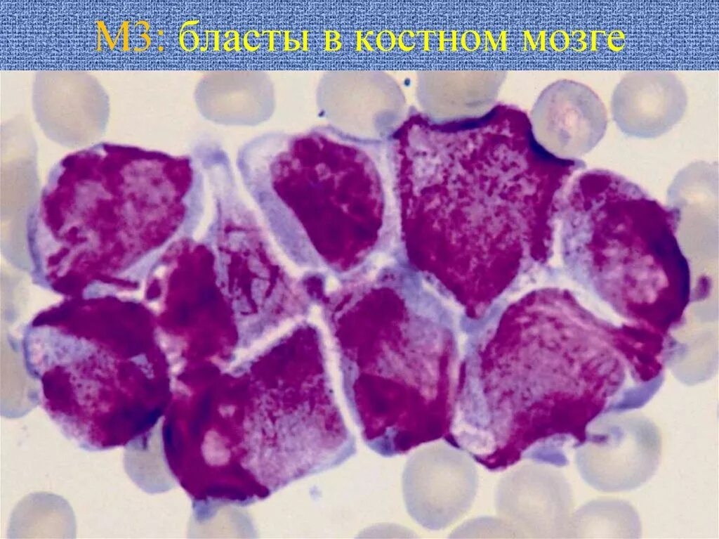 Костный мозг под микроскопом Medical problems dental students could identify part 2: Osteoporosis BDJ Student