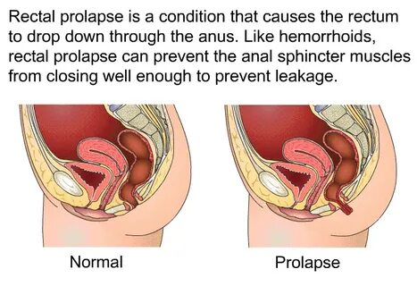 Артық салмағы бар әйелдердің порно гифтері