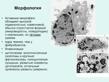 Макрофаги в щитовидной