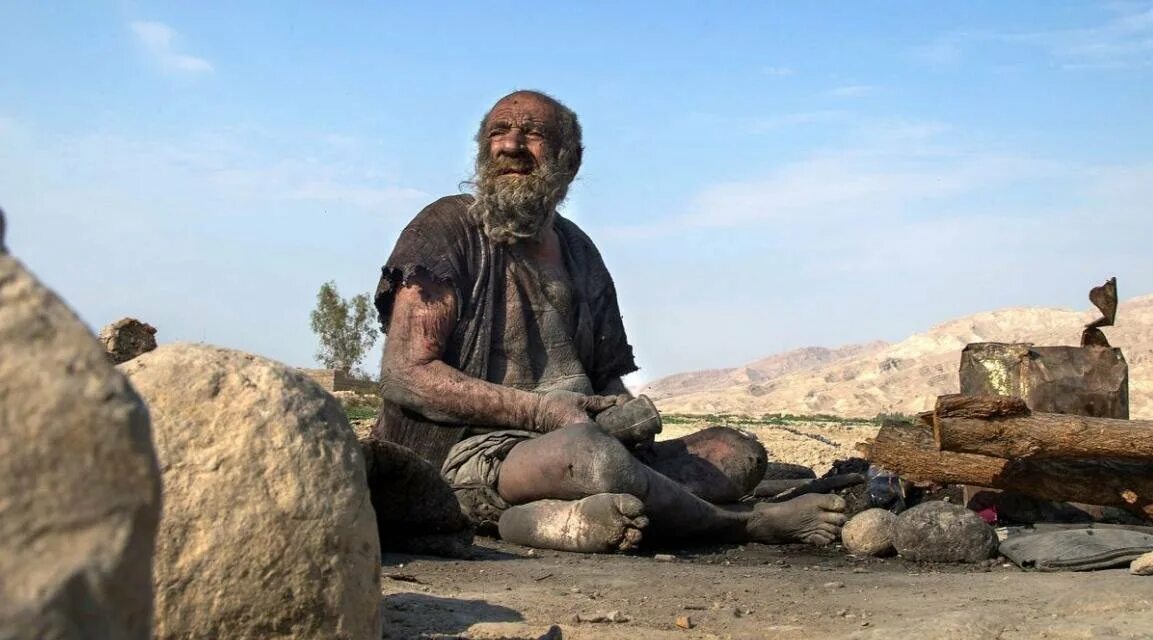 Аму хаджи человек который не мылся 60 лет. Аму хаджи, который не мылся 60 лет. Аму хаджи человек который не мылся 60 лет. Самый грязный человек в мире аму хаджи. Самый грязный человек в мире.