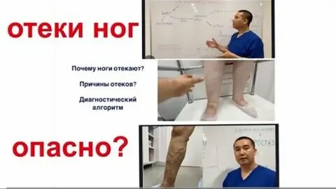 Отек ног причина что делать