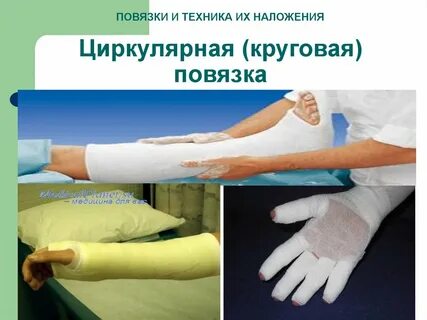 Циркулярная повязка