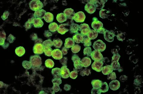 Амеба naegleria