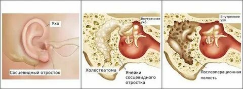 Почему кровит ухо