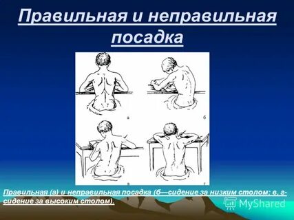Неправильная посадка