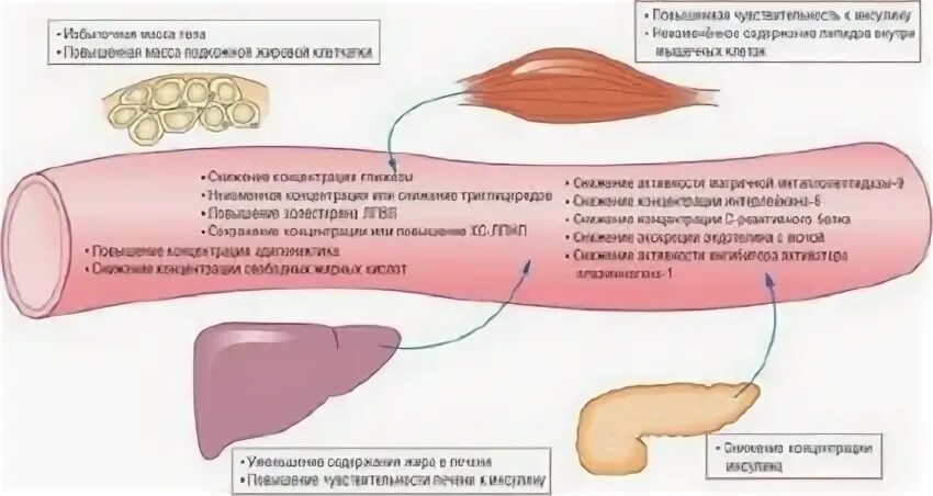 Инсулинорезистентность как лечить в домашних условиях. Инсулинорезистентность. Инсулинорезистентность симптомы. Симптомы инсулин инсулинорезистентность. Инсулинорезистентность у женщин.