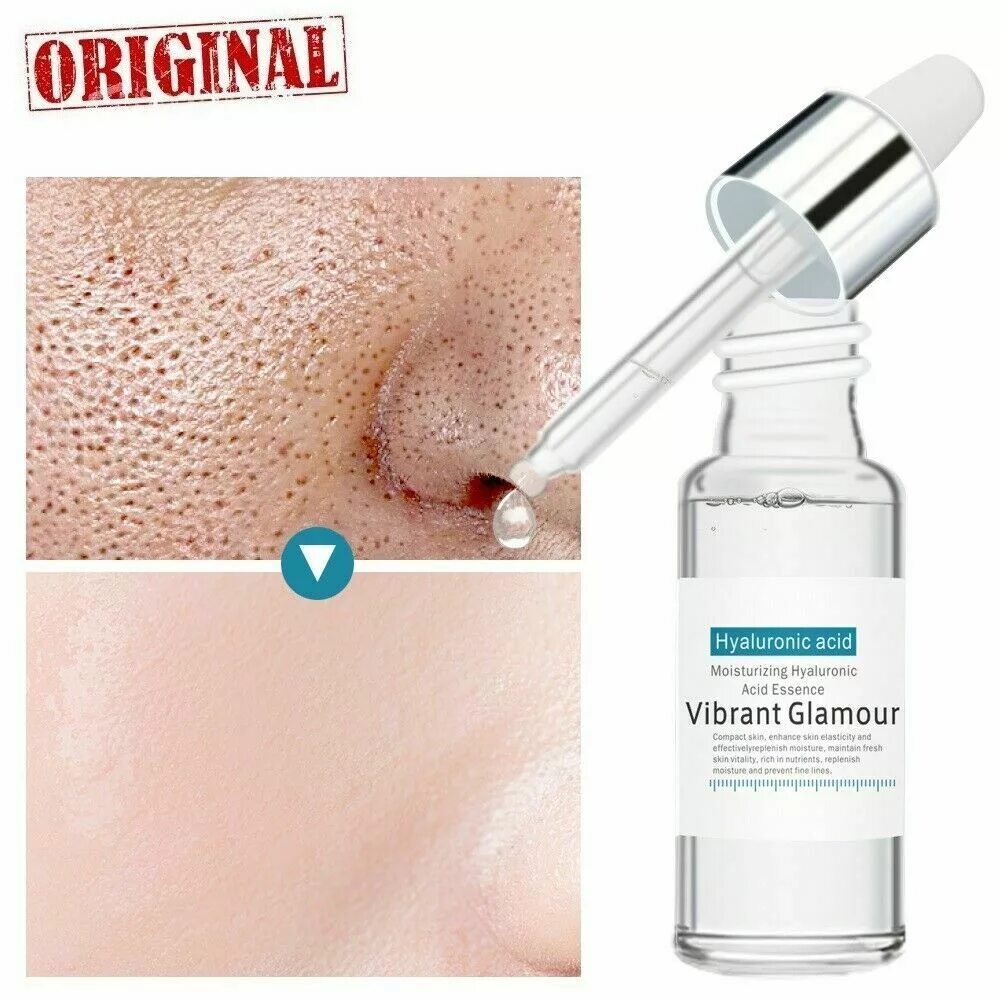 Что такое гиалурон. Гиалуроник ацид. гиалуроновая кислота для лица serum. гилауроновая или гиалуроновая кислота для лица. vibrant glamour hyaluronic acid moisturizing hyaluronic acid essence.