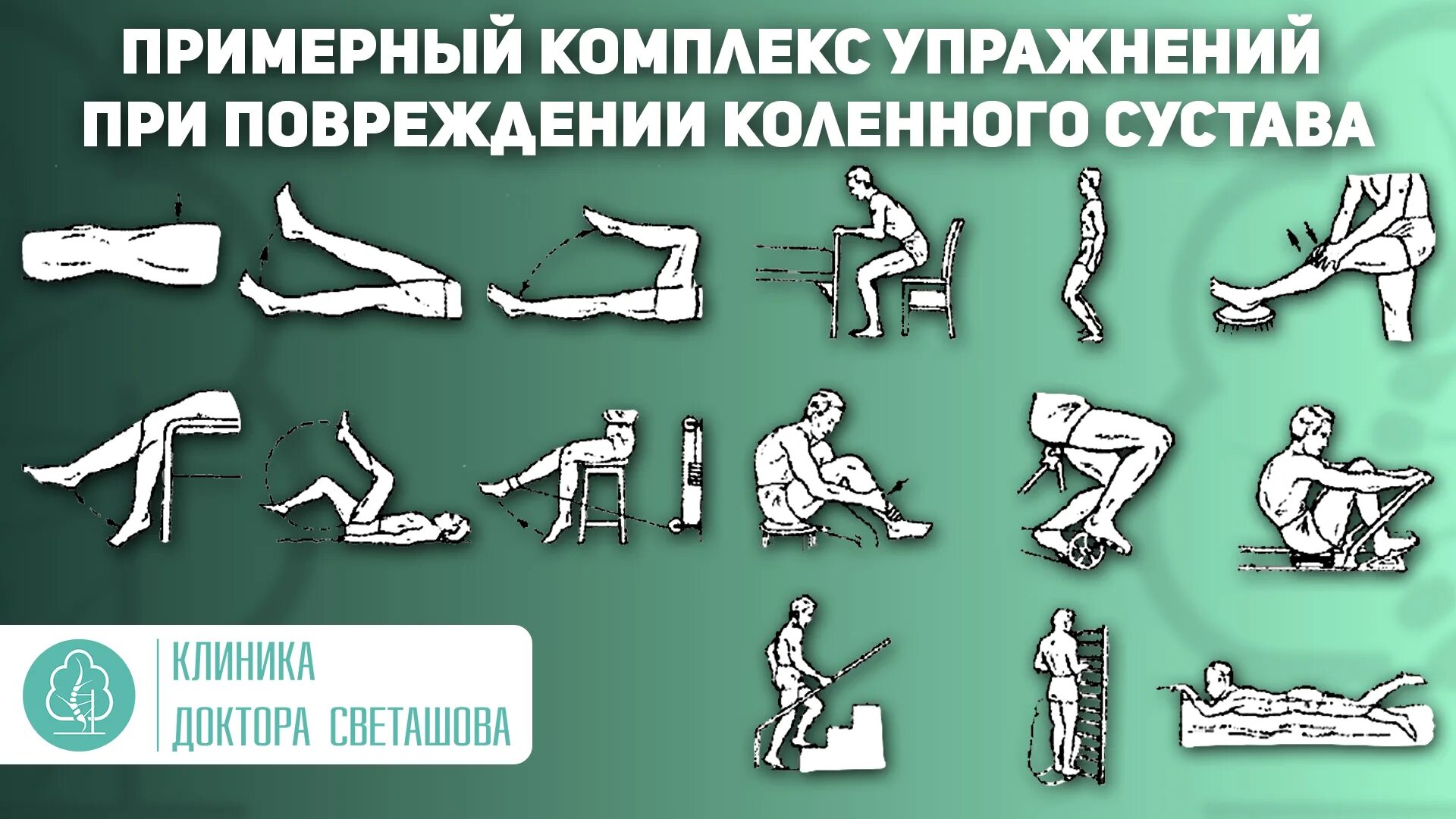 Лфк упражнения после операции. Лфк упражнения после операции