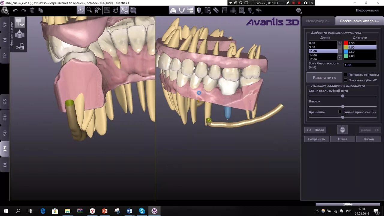 Avantis 3д стоматология. Виртуальный пациент программа. Авантис 3д. Авантис официальный стоматология. Авантис 3d стоматология.