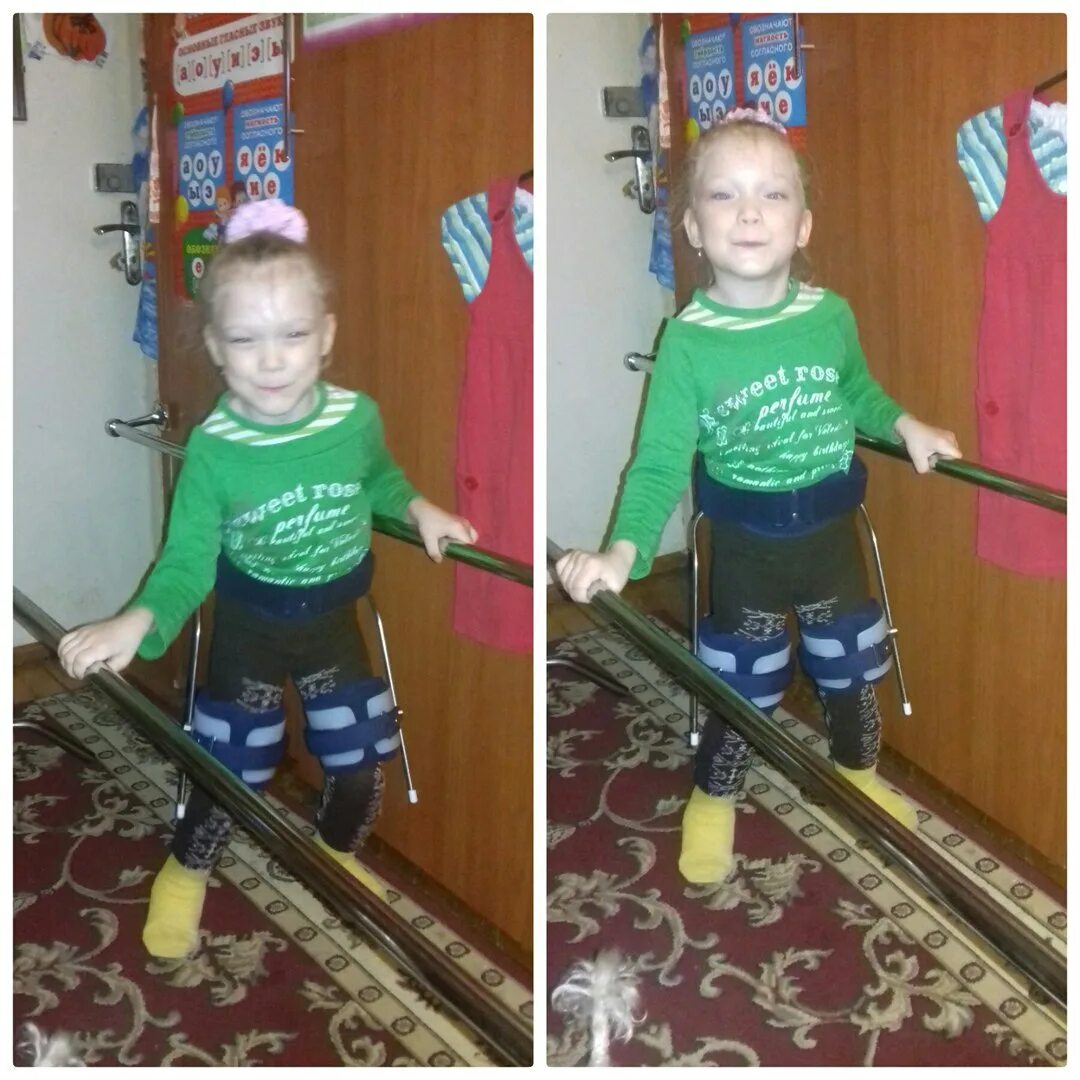 ортез свош. аппарат свош для детей дцп. аппарат swash для детей с дцп. Swash ребенок. аппарат свош дцп.