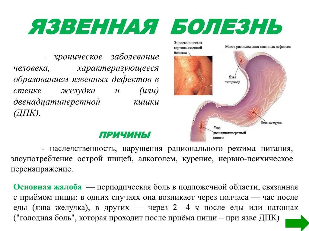 Язвенная болезнь желудка и 12 перстной. Обострение язвенной болезни желудка и 12-перстной кишки.. Проявления язвенной болезни желудка и 12-перстной кишки.. Причины заболевания язвенной болезни желудка.