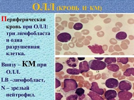 Лимфобласты