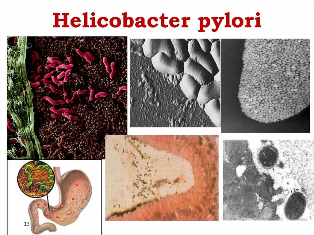 Хеликобактер пилори возбудитель. Бактерии хеликобактер пилори микроскопия. Хеликобактер пилори в желудке. Бактерия вызывающая гастрит и язву желудка.
