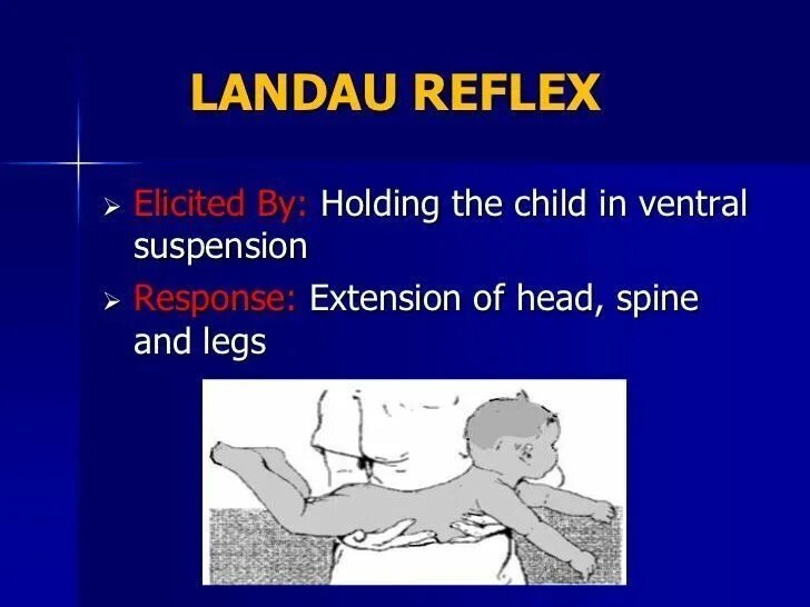 Нижний рефлекс Ландау. Рефлекс Ландау у грудничка. Верхний рефлекс Ландау.