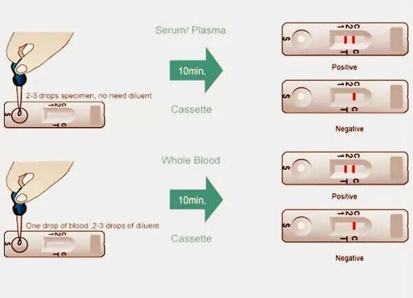 Тест крови в домашних условиях. Экспресс тест ВИЧ 1/2 положительный результат. Экспресс тест на ВИЧ интерпретация результатов. Экспресс тест на СПИД отрицательный. Проведение экспресс теста.