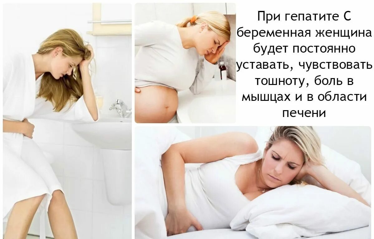 Гепатит во время беременности. Беременность. Гепатит симптомы у беременной. Гепатит с при беременности.