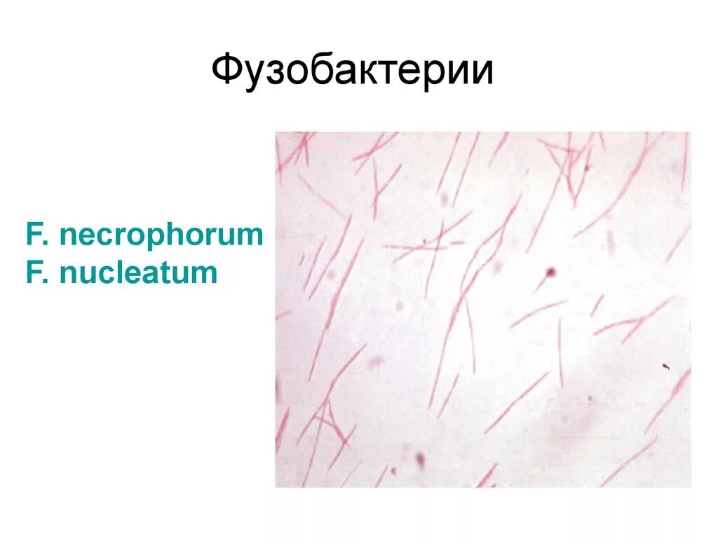 Fusobacterium spp. Фузобактерии нуклеатум. фузобактерии питательные среды. фузобактерии микробиология характеристика. fusobacterium spp микроскопия.