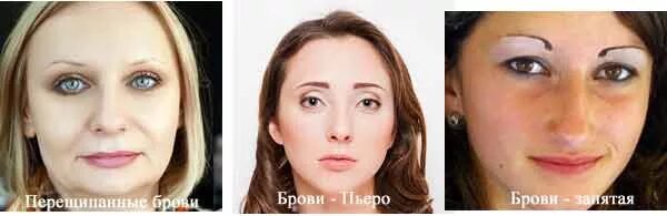 Картинки ПОЧЕМУ НЕ РАСТУТ БРОВИ