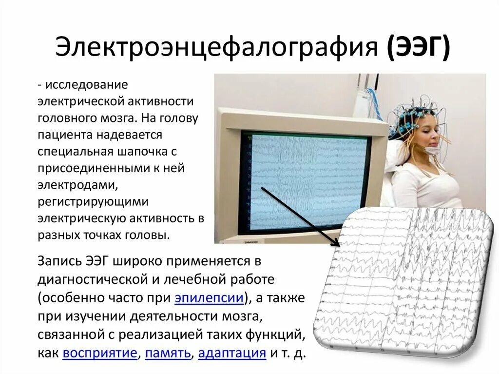 Электроэнцефалографическое исследование (ЭЭГ. ЭЭГ методика проведения. Методика ЭЭГ исследования. Методы регистрации электрической активности мозга. Электрическая активность головного мозга