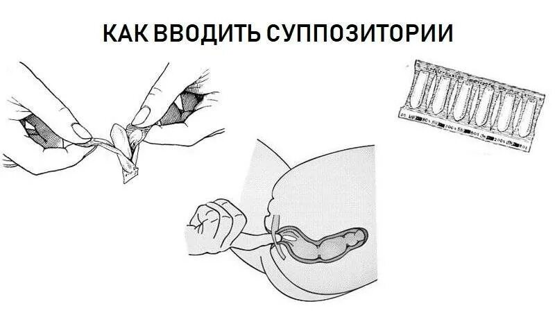 Что значит ректально вводить свечи по женски. Введение свечи во влагалище. как вставлять вагинальные свечи. вагинальные свечи правильное введение.