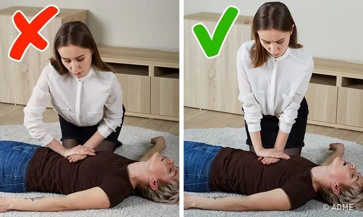 Девушке массируют сердце. Массаж сердца девушке. Массаж сердца девушке. Массаж сердца девушке в больнице. Массаж сердца девушке.