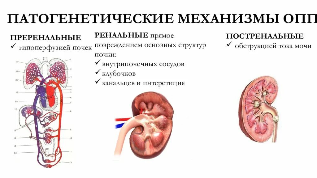 Острые почечные заболевания. Острое почечное повреждение. Преренальная, ренальная, постренальная.. Нефрит почечная недостаточность. Преренальное почечное повреждение. Острый интерстициальный нефрит гистология.