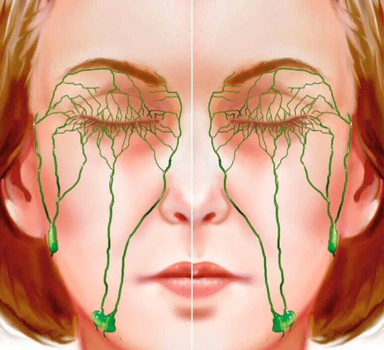 Лимфатическая система лица. Лимфоотток на лице глаза. Потоки лимфы на лице. Отеки застой лимфы
