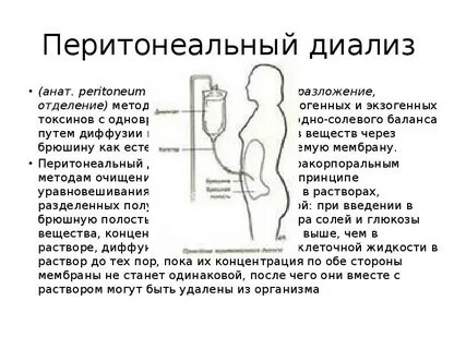Диализ живота