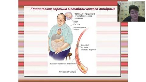 Паркс вебера рубашова