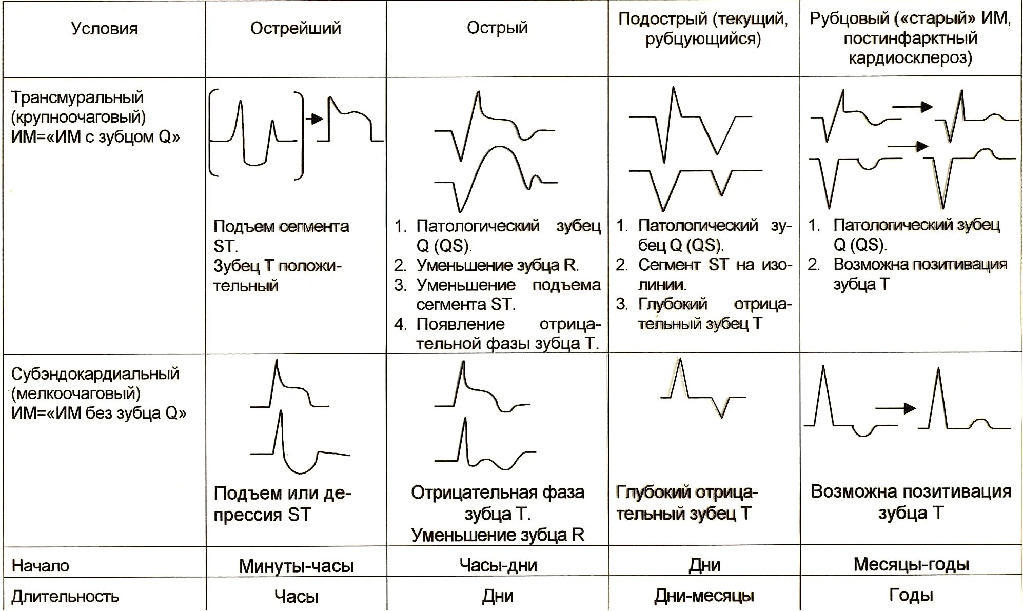 Изменение зубца q. Инфаркт миокарда классификация ЭКГ. ЭКГ при ИБС: инфаркт миокарда, острый период. Схема ЭКГ при инфаркте миокарда. ЭКГ при ишемии передней стенки миокарда.