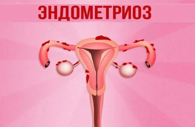 Менопауза матка