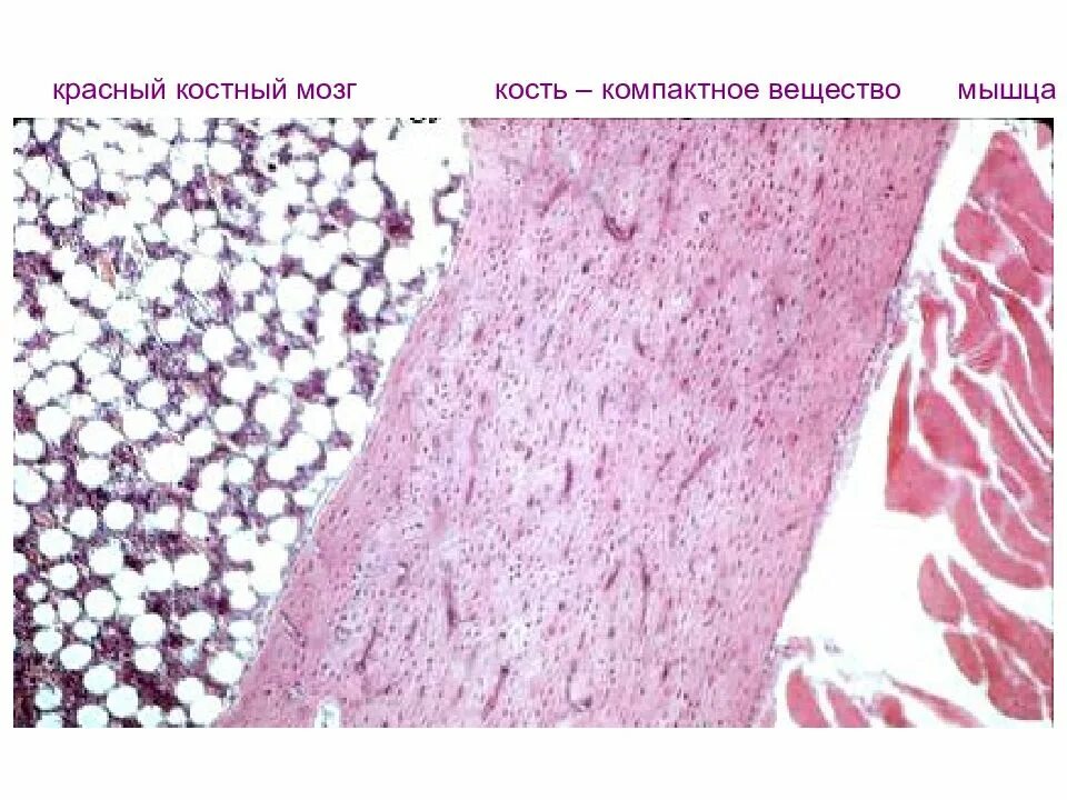 Красный мозг костей. Красный костный мозг кролика препарат. Основа красного костного мозга. Угнетение костного мозга. Синусоиды красного костного мозга.