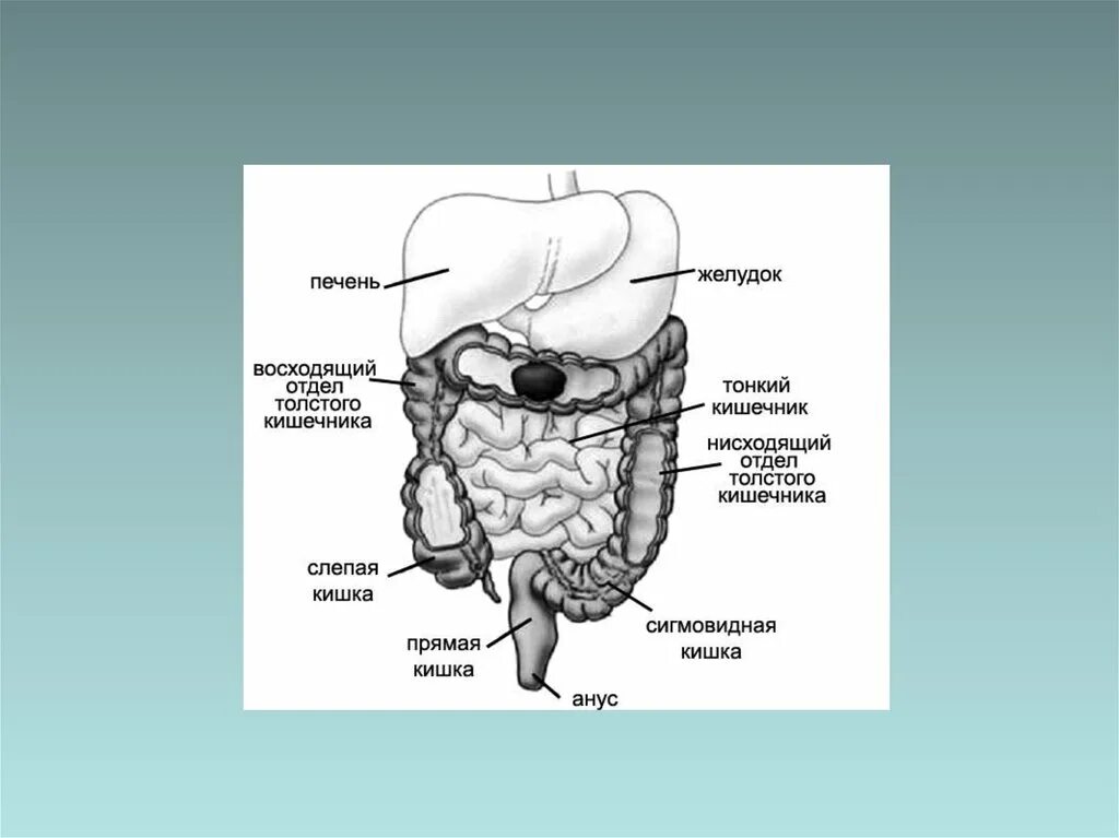 Слепая кишка рисунок. Как называется орган человека обозначенный на рисунке а. Слепая кишка рисунок со стрелками. Слепая кишка коалы.
