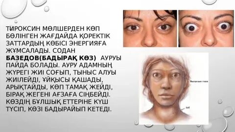 Yalangoch Anna Yankinaning samimiy fotosuratlari